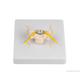 Csigolya gerincvelő metszettel