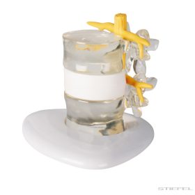 Porckorongsérv szimulátor