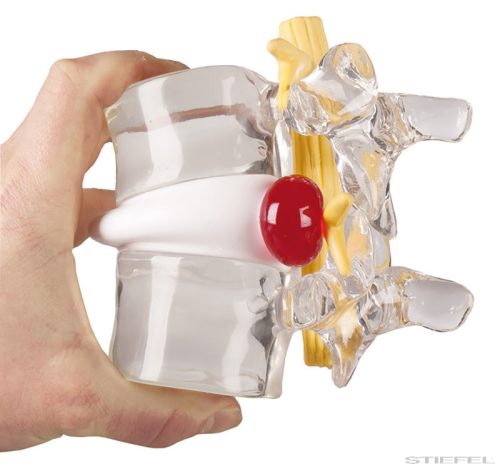 Porckorongsérv szimulátor