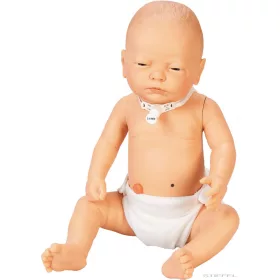 Speciális igényű baba, lány