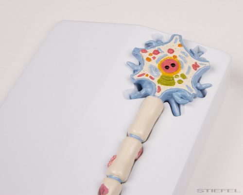 Neuron modell sclerosis multiplex stádiumokkal - EZ kiterjesztett valóság