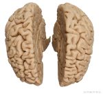 Emberi agy (férfi), igazi másolat