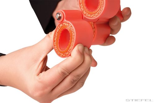 Arteriosclerosis modell, 4 szakasz