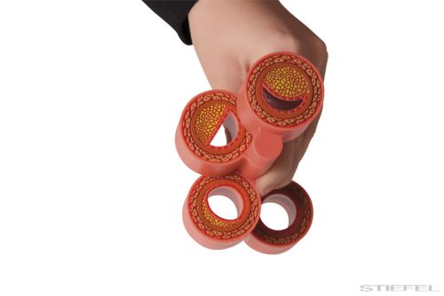 Arteriosclerosis modell, 4 szakasz