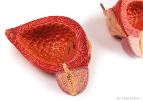 Húgyúti rendszer, 5 részes