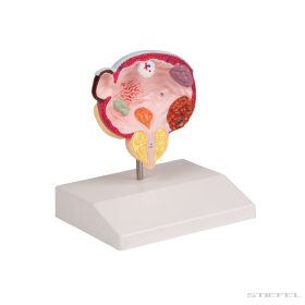 Hólyag és a prosztata betegségei