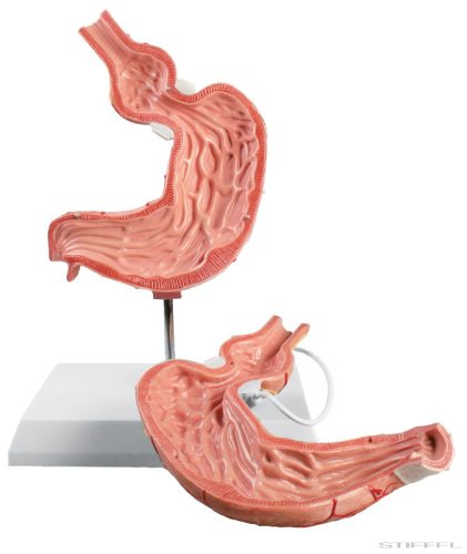 Gyomor modell, gyomorszalaggal