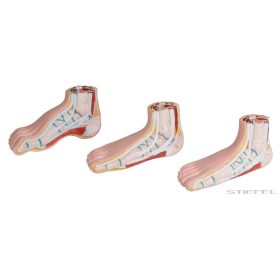 Lábfej elváltozások, 3 részes szett