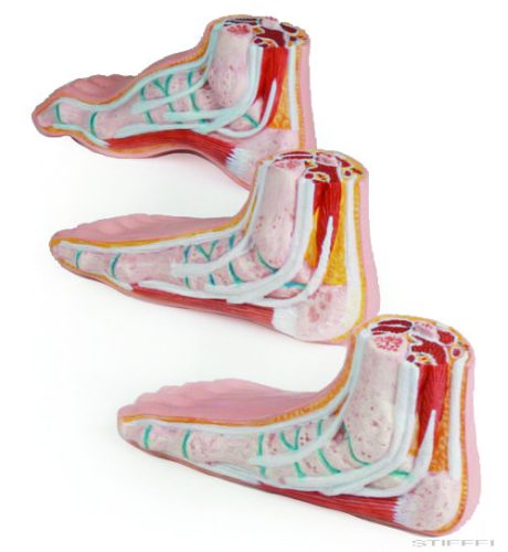 Lábfej elváltozások, 3 részes szett