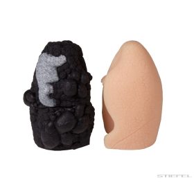 Tüdőrák összehasonlító modell