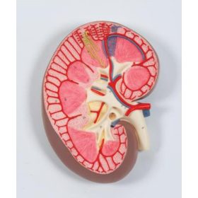 Vese részlet modell, 3x-os nagyítással