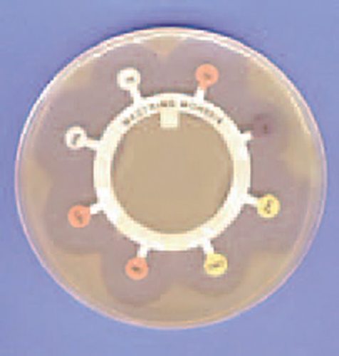 M13 Antiobiotikus árboc gyűrűk – 100db (BN/EXP)