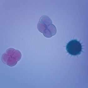 Vegyes pollenszemek mikroszkópos preparátum