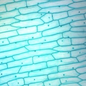 Vöröshagyma héj epidermisz, teljes metszet